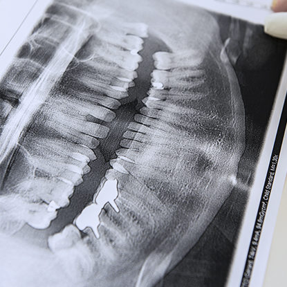 L’empreinte des dents